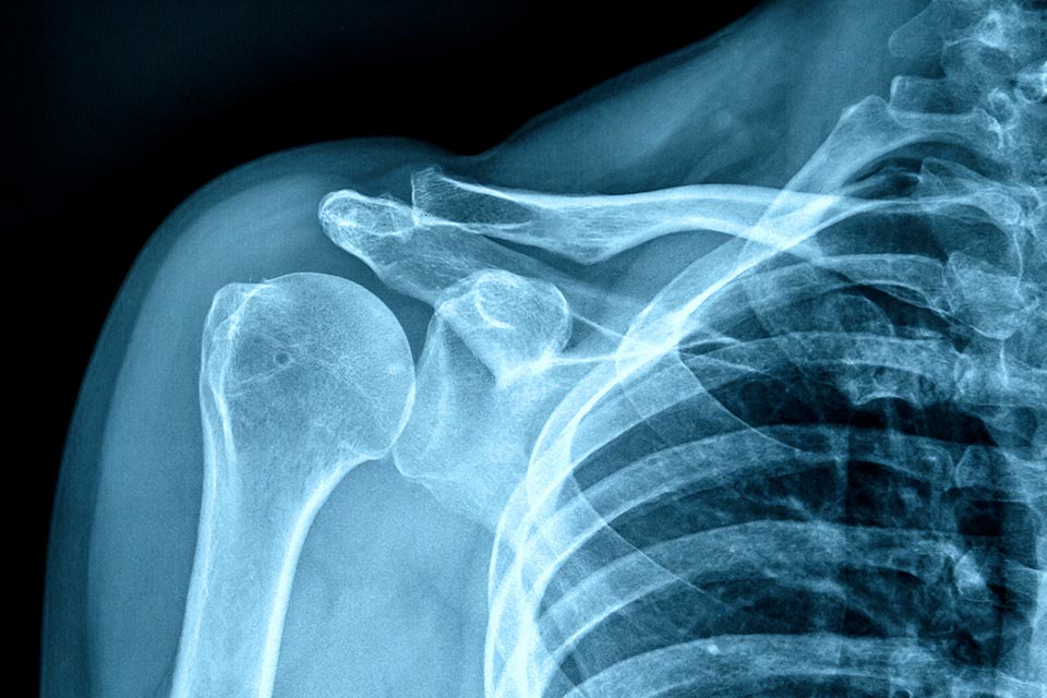 X Ray Examples What Are Gamma Rays Definition Examples Video X Ray Examples What Are Gamma Rays Definition Examples Video
