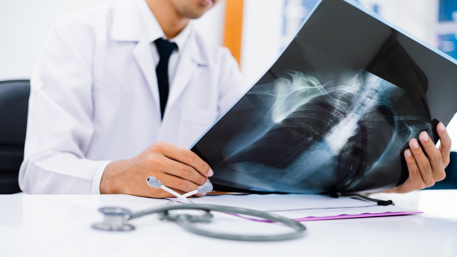 What Can a Chest Xray Diagnose? A Comprehensive Guide