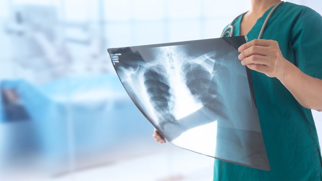 A healthcare professional in scrubs is holding an X-ray image of a chest, displaying the ribcage and lungs. The background appears blurred, likely indicating a medical setting.