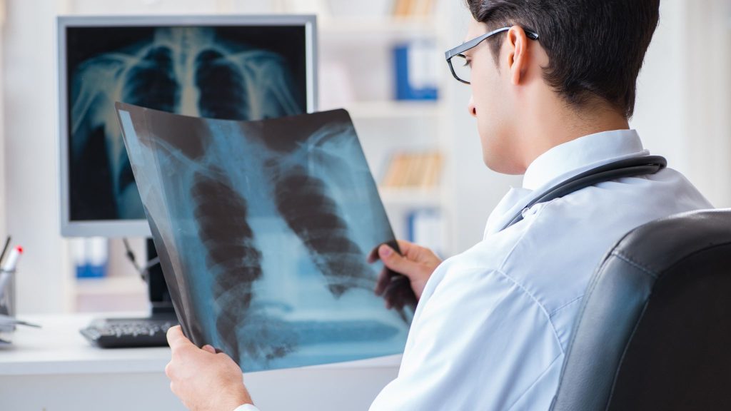 A doctor examining a chest X-ray in an office.